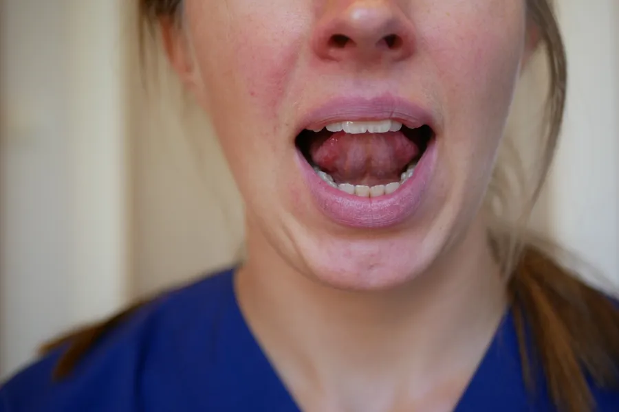 En kvinne med åpen munn