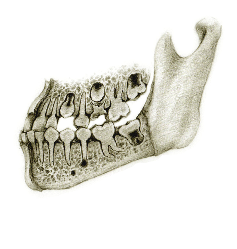 Røntgen av kjeve ved OI