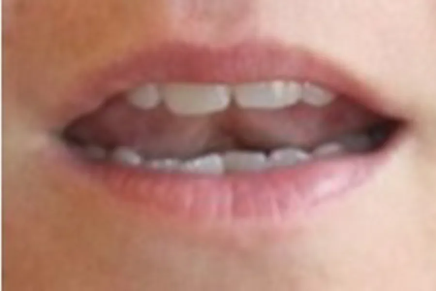 3 oralmotoriske øvelser