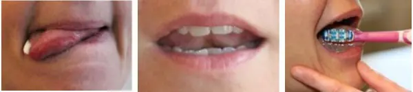 3 oralmotoriske øvelser